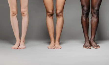 Jak leczyć nierówny koloryt skóry