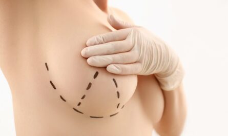Usunięcie piersi u kobiety - jak to wpływa na Ciebie?